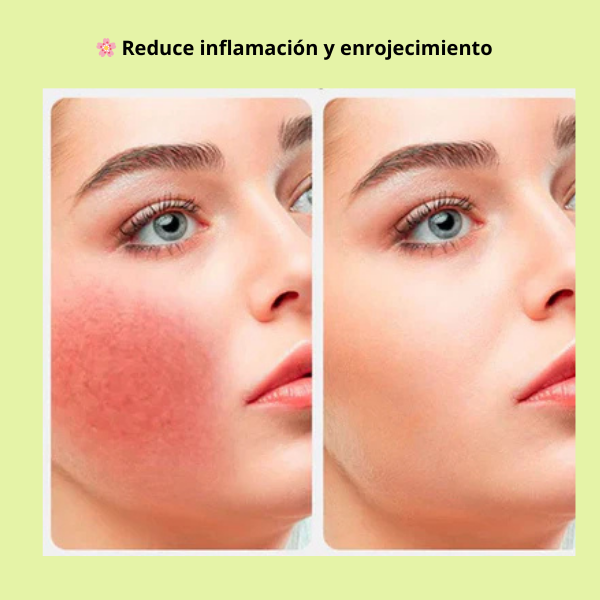 Molde de Hielo para el Cuidado Facial 💙❄️